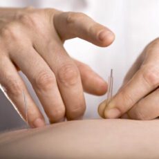 Acupuncture at Northglenn Clinic- Your path to better health